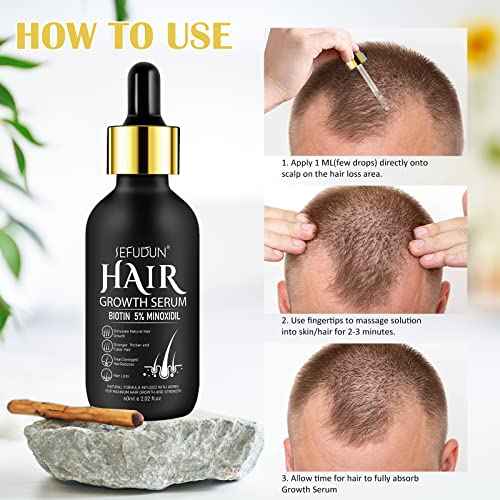 2 Pack 5% Minoxidil Hair Growth Serum,Minoxidil For Men and Women Hair,2.02 oz Biotin Hair Regrowth Serum Treatment For Getting Thicker Healthier Hair