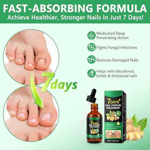 Ginger Nail Growth Strengthener Serum ? Ginger-Infused Nail Repair Oil for Care, Natural Nail and Strengthener Solution