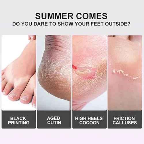 Foot Peel Mask 6 Pack,Foot Spa Foot Care For Women Peel Mask With Lavender For Men And Women Feet Peeling Mask Exfoliating, Callused Foot Mask Peel,Foot Mask For Dry Dead Skin,Remove Dead Skin
