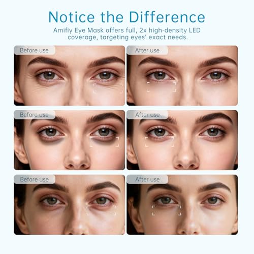 Red Light Therapy for Eyes, Infrared LED Eye Mask for Under Eye Dark Circles, Puffiness & Wrinkles, Anti-Aging Collagen Booster in Just 3 Minutes a Day, Soft Silicone