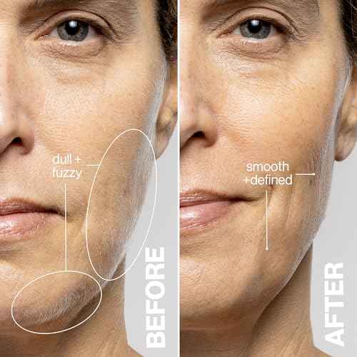DERMAFLASH LUXE+ Sonic Dermaplaning Tool for Face Peach Fuzz Removal, Anti-Aging and Exfoliation, Pop Pink