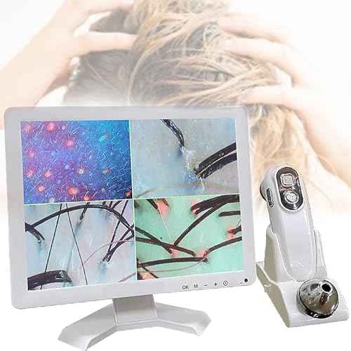 Skin Hair Scalp Detector Analyzer,15inch LCD Screen Digital Skin Detector, Multifunctional Scalp Detector Machine, Rechargeable Hair Follicle Skin Analyser Machine
