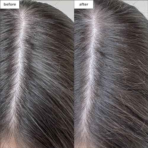Briogeo Scalp Revival Charcoal + Biotin Dry Shampoo, Clarifying Shampoo Scalp Cleanser for Dry Scalp & Itchy Scalp, Featuring Tea Tree Oil for Hair, Vegan, Cruelty-Free, 1.7 oz