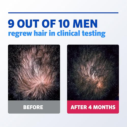 Men¡¯s Rogaine 5% Minoxidil Topical Foam, One Month Supply