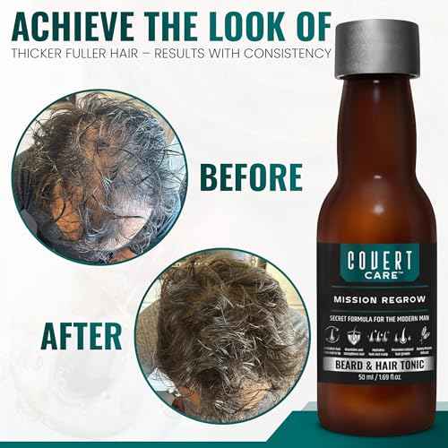 Hair and Beard Thickening Serum for Men ? Lightweight Root Activator for Thinning Hair, Scalp Nourishment for Fuller, Stronger-Looking Hair