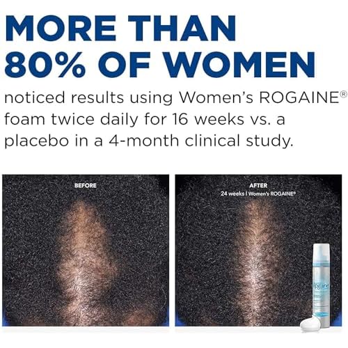Rogaine 5% Minoxidil Foam, Topical Once-A-Day Hair Loss Treatment for Women to Regrow Fuller, Thicker Hair, Unscented, 2-Month Supply, 2.11 oz