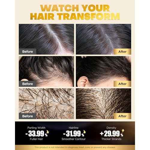Tripeptide-Infused Hair Growth Biotin Shampoo and Conditioner Set, Onion Anti-Loss Volumizing Moisturizing Treatment for Soft Shine Hair, Dandruff Routine Rosemary Shampoo for Men and Women, 2x16.9oz