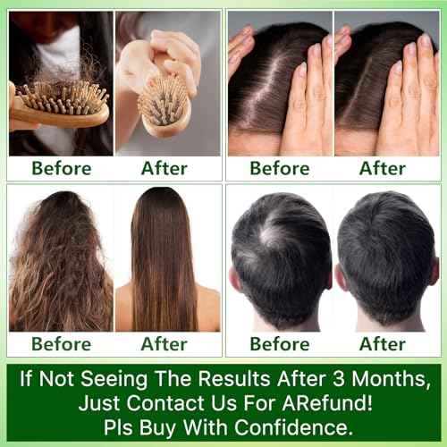 Rosemary Oil, Hair Growth Serum, Heat Protectant Spray, Biotin Argan Oil Products for Thinning Hair & Hair Loss Treatment, Gifts for Women, Men