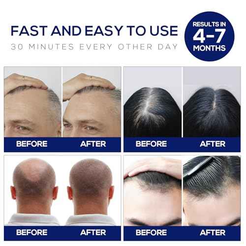 Laser Hair Growth Cap, Red Light Therapy Cap, Low Level Laser Therapy (LLLT) Equipment for Promoting Hair Growth in Women and Men£¨Black£©