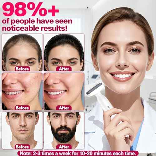 Derma Stamp, MONESAO Microneedling Stamp for Skin Face Hair Scalp Beard, Microneedle Dermastamp Tool with 2 Replacement Heads, Micro Needling Stamp Kit for Women and Men