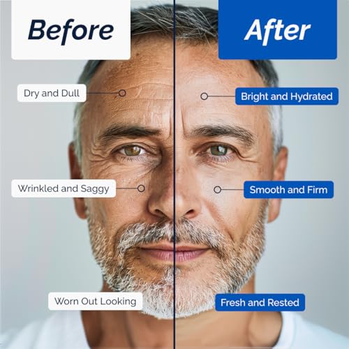 Face Cream ? Moisturizer with Retinol and Hyaluronic Acid, Refreshing Effect, Reduces Wrinkles and Dark Spots, Improves Skin Elasticity and Radiance