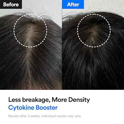 REFILLED Booster Plus Moisture | Hair Growth Serum & Thickening Scalp Treatment with Built-in Massager for Men & Women | Hair Loss & Thinning | Fuller & Baby Hair Regrowth | Fast-Absorbing with Biotin