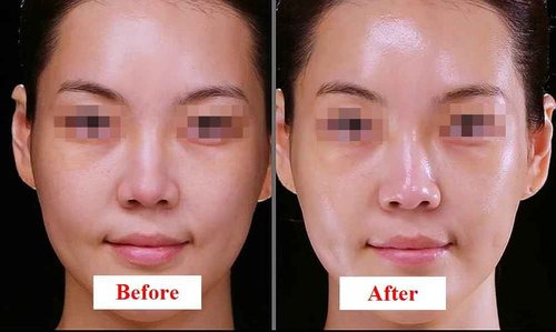 WHITESILK Ultimate Youth Elixir : LACTOFERRIN (liposome), Micro-Peptide C3™ & Volufiline with HyalFerrin™ Technology Face Serum (40ml / 1.32oz)