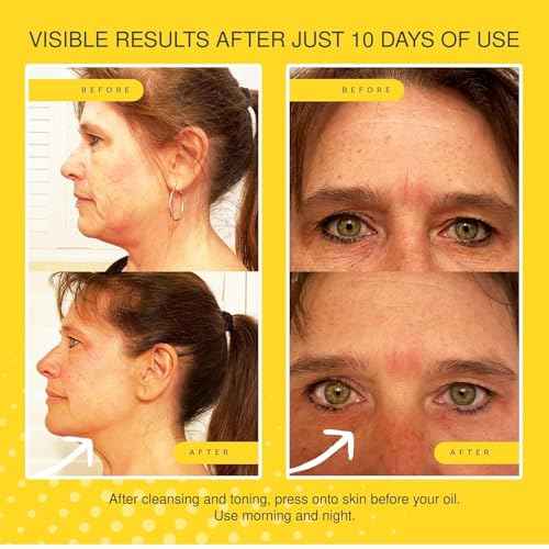 Jojoba Ultimate Serum - Anti-Aging - Reduces Appearance of Wrinkles, Crow?s Feet, Frown Lines & Fine Lines - Visibly Increases Skin Firmness - Hydrates & Tightens - 30ml