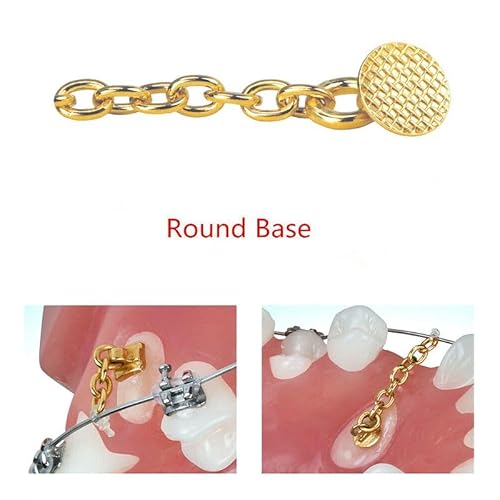 10 Packs Sino Dental Group Orthodontic Braces Eruption Appliance With Traction Chain,Gold/Sliver, Round/Retangular Base (Round, Golden)