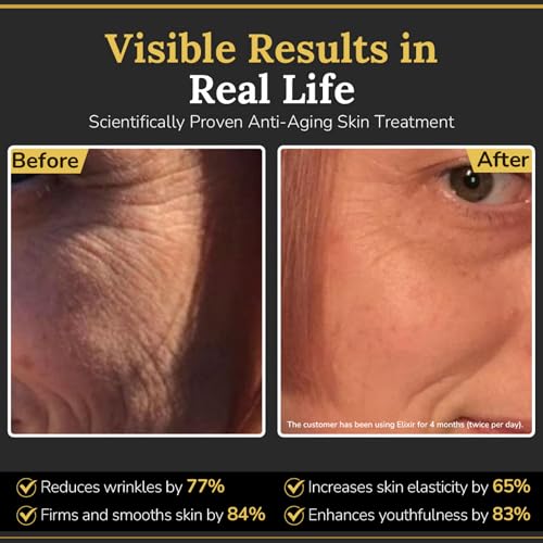 Elixir Bee Venom Skin Treatment Cream ? Anti-Aging Face Cream with Hyaluronic Acid & Coenzyme Q10 ? Deep Wrinkle Filler & Instant Face Lift Treatment ? 50ml