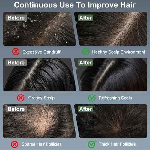 Laser Therapy Hair Growth Comb, Electric Scalp Massager, Handheld Comb-Shaped Hair Regrowth Device for Hair Growth & Hair Care for Thicker, Healthier Hair