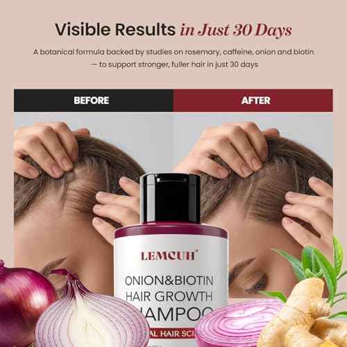Onion & Biotin Hair Growth Shampoo: Infused With Natural Rosemary Tea Tree Oil Anti Hair Loss Shampoo - Scalp Smooths Thickening Formula Support Hair Regrowth For Women Men (12.5 Fl Oz)