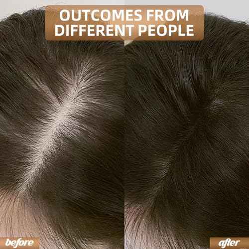 Red Light Therapy for Hair Growth, Breathable Cap Panels with Quick-Release Function