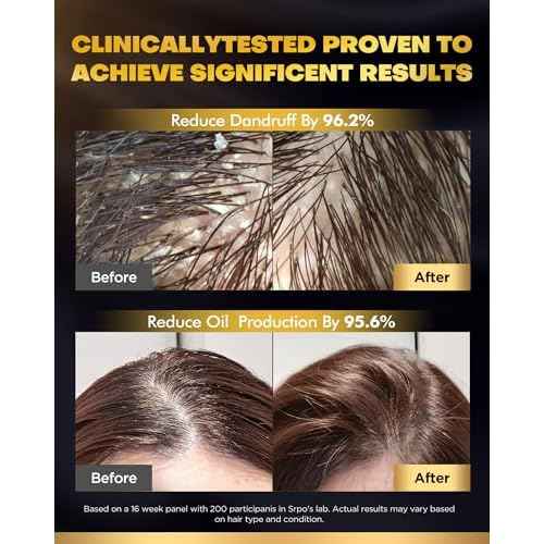 Tripeptide-Infused Hair Growth Biotin Shampoo and Conditioner Set, Onion Anti-Loss Volumizing Moisturizing Treatment for Soft Shine Hair, Dandruff Routine Rosemary Shampoo for Men and Women, 2x16.9oz