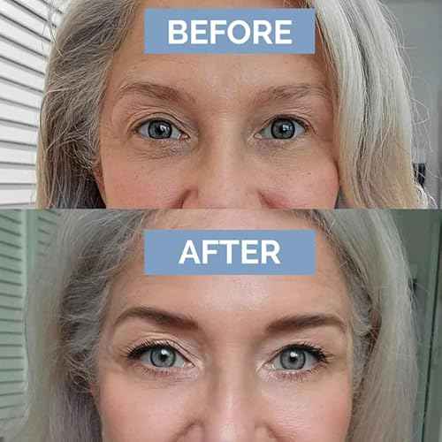 Prime Prometics PrimeBrow Complete ? 3-in-1 Eyebrow Care for Mature Women ? Eyebrow Mousse Tints, Magic Spoolie Brush Shapes, Eyebrow Growth Serum Fills Bald Spots (Deep Brown)