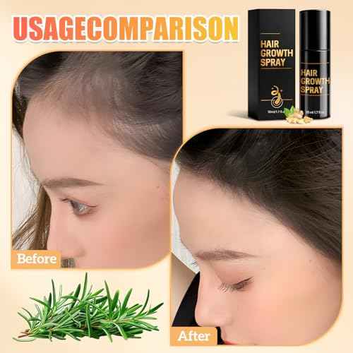 Hair Growth Spray, Hair Growth Spray for Men and Women, Promotes Thicker Fuller Hair ?All Hair Types