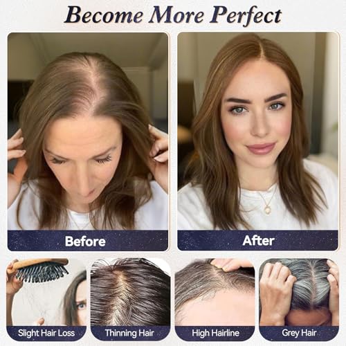 starluck Real Human Hair Toppers for Women 10 Inch Human Hair Topper no Bangs, 3 * 4.5 inches Swiss Base Suitable for ThinningHair Cover Grey Roots(Mixed Silver Grey)