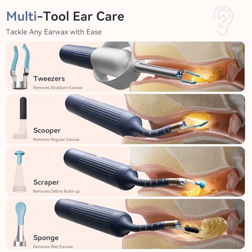 Ear Wax Removal Tool Kit: ZERONDER Ear Cleaner with Camera 1080P HD - Ear Canal Cleaning with 6 LED Lights for Adults & Kids