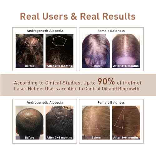 Laser Hair Growth System (FDA Cleared), Hair Regrowth Helmet & Laser Cap, Hair Loss Treatment for Men and Women, Low Level Laser Therapy for Hair Growth, Anti-Thining Treatment£¬36 Pink
