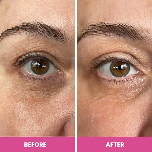 PRIME PROMETICS PrimeEyes Hydrate Under Eye Cream for Mature Women ? Hydrating Eye Cream for Dark Circles and Wrinkle Repair ? Soft, Glowing & Healthy Under Eyes