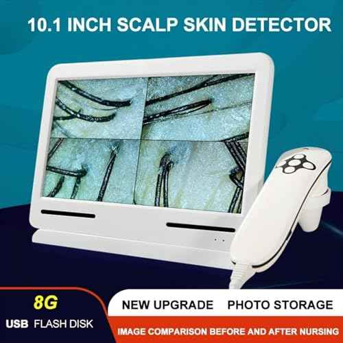 Skin Diagnosis Hair Analyzer, 10.1 Inch 200x LCD Screen Digital Skin Detector Moisture Tester Hair Skin Analyzer Rechargeable Skin Oil Moisture Magnifying Tester