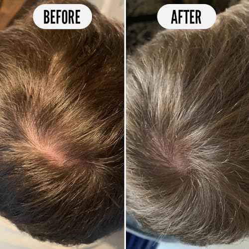 Noughty 97% Natural Get Set Grow Tonic, Leave in Treatment for Thicker and Fuller Looking Hair, 97% Natural, with Pea Complex and Hyaluronic Acid 75ml