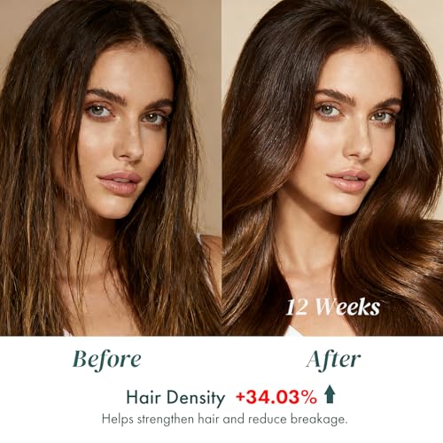 ALFHEIM Saw Palmetto Scalp Serum for Boost Follicle - Infused With Caffeine, Biotin for Thicker Hair - Balance Scalp, Rejuvenate Hair Follicles £¦ Improve Hair Density - 1.69 fl oz + Serum Applicator