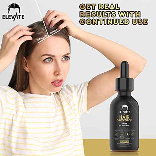 Elevate Hair Regrowth Treatment 5% Minoxidil Solution ? Biotin Serum Hair Growth Oil for Men & Women - Thicker Fuller Stronger Hair - Stops Hair Loss & Thinning - Natural Hair Thickening Treatment 2oz