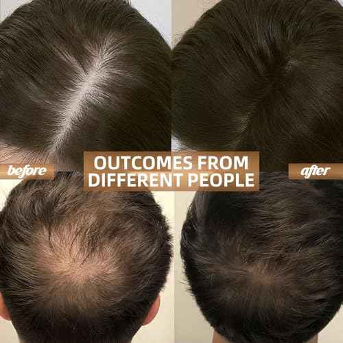 Cordless Red Light Therapy for Hair Growth Cap, Infrared Red Light Therapy to Support Scalp Health, Reduce Hair Loss & Shedding