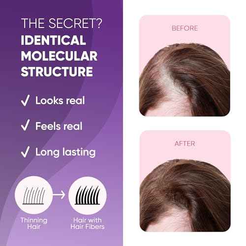 GBG Hair Fibers for Thinning Hair & Bald Spots (Dark Brown) - 25g Bottle - Conceals Hair Loss - Instant Cover Up & Volume in 30 Seconds, Hair Powder for Women & Men - Cruelty Free