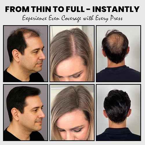 Hair Fibers for Thinning Hair, Hair Building Fibers Spray with Spray Applicator, Undetectable & Long-lasting, Instant Hair Coverage for Men & Women (Black, 30g)