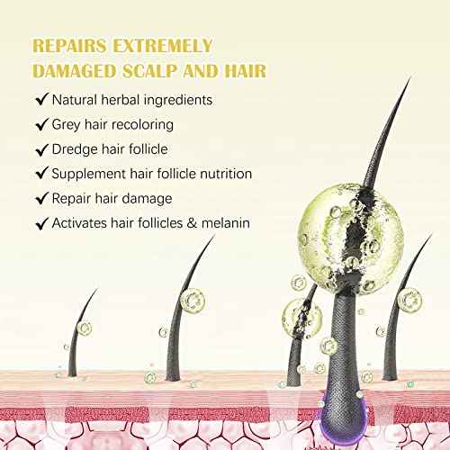 2Pack 5% Minoxidil for Men & Women, Minoxidil for Women Hair Growth, Minoxidil for Men Beard, Natural Hair Regrowth Treatment for Hair Loss Hair Thinning, Thicker Fuller Healthier Hair