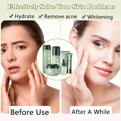 Avocado Skin Care Set for Women,6PCS Skincare Kits with Facial Cleanser, Toner, Serum, Lotion,Cream, Eye Cream, Moisturizing Korean Skincare Set,Anti-Aging Skin Care Set,Birthday Gifts for Women