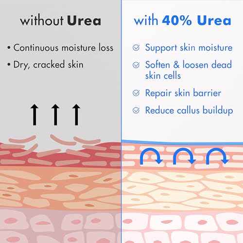 Ebanel Urea Cream 40% plus Salicylic Acid 2%, Foot Cream for Dry Cracked Heels Feet Knees Elbows Hands, Foot Dead Skin Cuticle Callus Remover Toenail Softener, Keratolytic Skin Barrier Repair