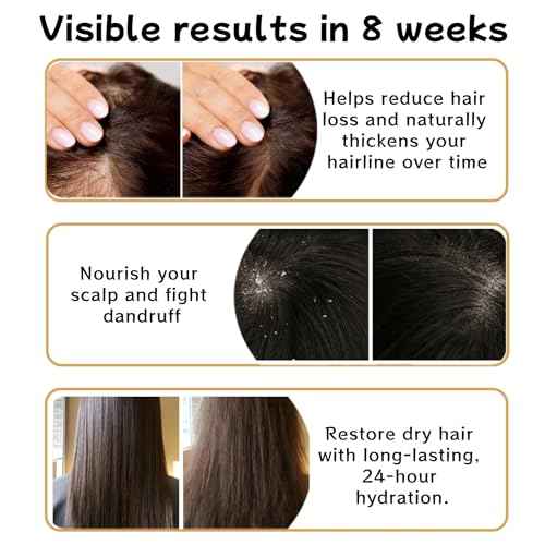 2 PCS Anti Hair Loss Shampoo, Promote Hair Growth and Thickening & Strengthening Shampoo with Various Plant Extracts for Thinning Hair Women£¨300ml£©