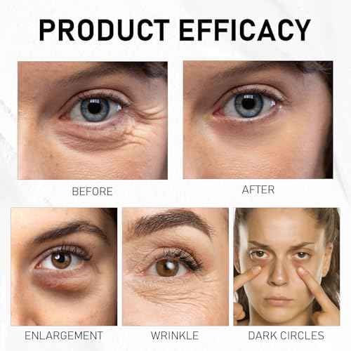 Under Eye Balm Stick for Under Eyes Bags,2025 New Turmeric Cream Erases Eyes Bags Within Minutes,Erase for Dark Circles Puffiness,Moisturizing Under Eye Balm for Travel Care Serum for Women(2PCS)