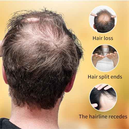 Hair Growth & Reset Oil, Rosemary Oil for Hair Growth, Hair Serum for Dry Damaged Hair and Growth Thin Hair, Scalp & Hair Strengthening Treatment, 55ml/1.86fl Oz (1PCS)