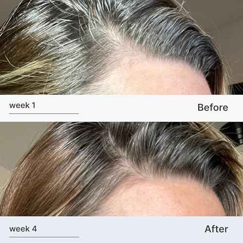 Better Not Younger Hair Thickening Serum for Women Over 40 ? Scalp Care, Hair Density Treatment and Anti-Aging 2fl.oz ? Fortifying Serum with Biotin & Ginger. Promotes Stronger, Thicker-Looking Hair.