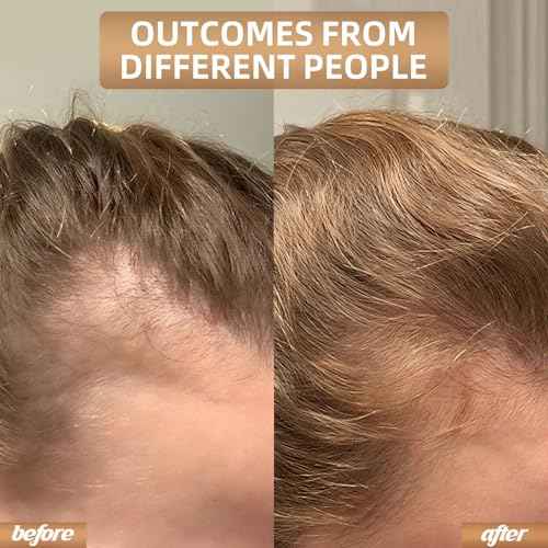 Red Light Therapy for Hair Growth, Cordless Hair Regrowth for Home & Travel, Laser Therapy Cap