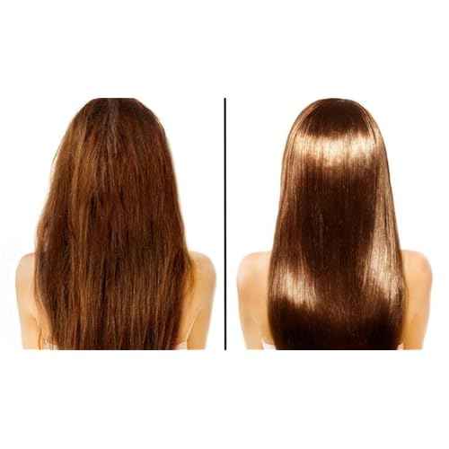 Brazilian HAIR SURGERY reatment Hair Liss Kit 32oz/960ml - At Home Keratin Treatment Smoothing and Straightening - Keratina para Alisar el Pelo - For All Hair Types Cirugia Capilar para el cabello