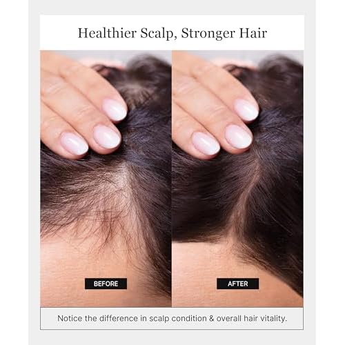 Invigorating Shampoo - Hair Growth Shampoo for Women & Men with Human Stem Cell Extract ? Cleanses, Strengthens & Moisturizes to Support a Healthier Scalp & Fuller-Looking Hair - 8 oz