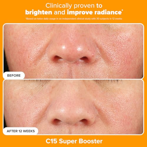 Paula's Choice Brighter Days Ahead Kit, Vitamin C and AHA Trio, Includes Travel Size C5 SPF Face Sunscreen, Mandelic Acid Exfoliant, C15 Vitamin C Booster Serum, Brightening & Resurfacing, 3-Piece Set