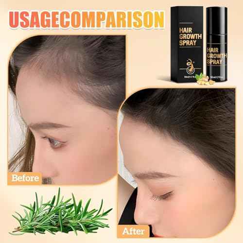 Hair Growth, Hair Growth Spray, motes Thicker, Fuller Hair For Women & Men, Natural Ingredients Hair Thickening Sprays For All Hair Types£¨2PCS£©