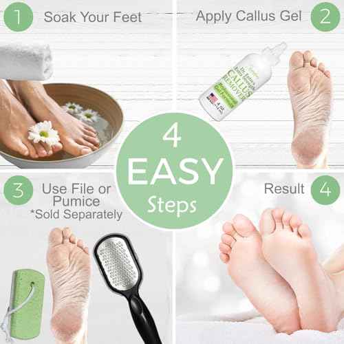 Dr. Entre's Callus Remover Gel: Extra Strength Callus Remover for Feet, Foot Callus Remover, Foot Care, Pedicure Tools Supplies, Dead Skin Remover, 4 oz